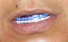 Grillz dentale d'oro removibile, gioiello per i denti nato nella cultura hip-hop