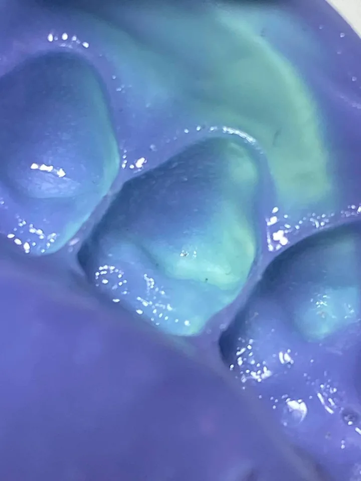 Impronta dentale corretta nel dettaglio: cuspidi dei molari definite, superficie senza bolle