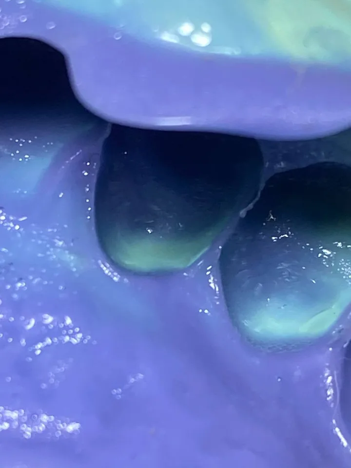 Impronta dentale corretta: incisivi profondi e completi con margini nitidi nel silicone