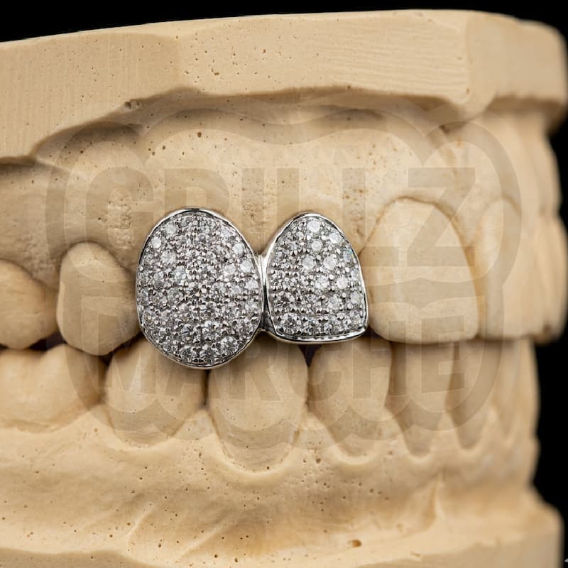 Full Iced out · 2 denti — grillz su misura fatto a mano nelle Marche, Grillz Marche