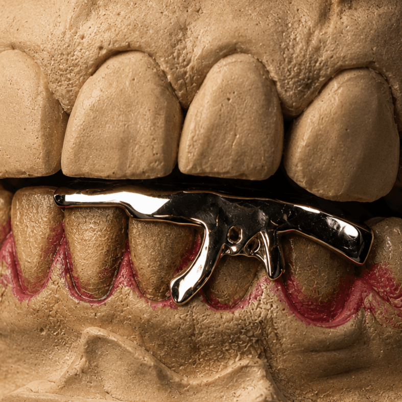 Ak47 Custom Design · 4 denti — grillz su misura fatto a mano nelle Marche, Grillz Marche